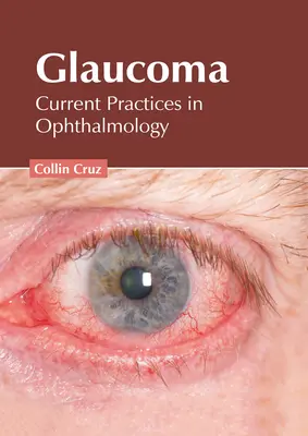 Glaukóma: A szemészet jelenlegi gyakorlata - Glaucoma: Current Practices in Ophthalmology