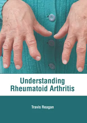 A reumás ízületi gyulladás megértése - Understanding Rheumatoid Arthritis