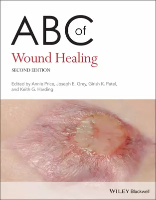 A sebgyógyítás ABC-je - ABC of Wound Healing