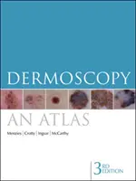 Dermoszkópia: Atlasz - Dermoscopy: An Atlas
