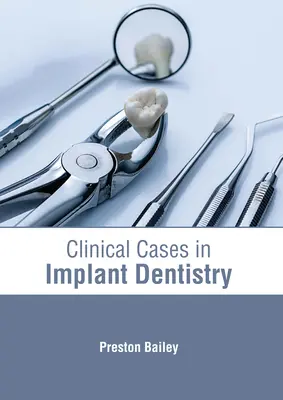 Klinikai esetek az implantációs fogászatban - Clinical Cases in Implant Dentistry