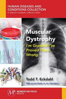 Izomdisztrófia: Hálás vagyok, hogy bebizonyítottam, hogy tévedtek. - Muscular Dystrophy: I'm Grateful I've Proved Them Wrong