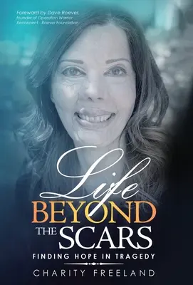 Élet a sebhelyeken túl: Reményt találni a tragédiában - Life Beyond the Scars: Finding Hope in Tragedy