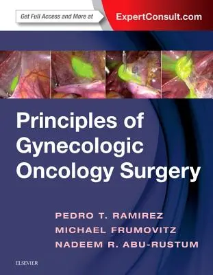 A nőgyógyászati onkológiai sebészet alapelvei - Principles of Gynecologic Oncology Surgery