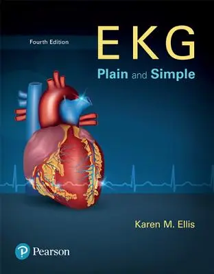 EKG prostě a jednoduše - EKG Plain and Simple