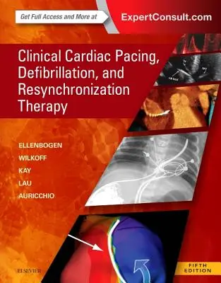 Klinikai szívritmusszabályozás, defibrilláció és reszinkronizációs terápia - Clinical Cardiac Pacing, Defibrillation and Resynchronization Therapy