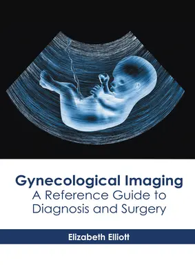 Nőgyógyászati képalkotás: A Reference Guide to Diagnosis and Surgery - Gynecological Imaging: A Reference Guide to Diagnosis and Surgery