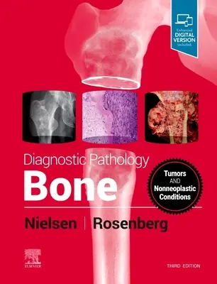 Diagnosztikus patológia: Bone - Diagnostic Pathology: Bone