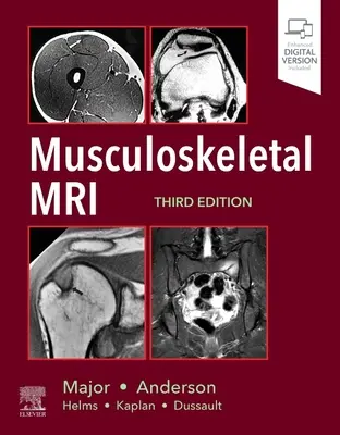 Mozgásszervi MRI - Musculoskeletal MRI