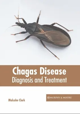 Chagas betegség: Diagnózis és kezelés - Chagas Disease: Diagnosis and Treatment