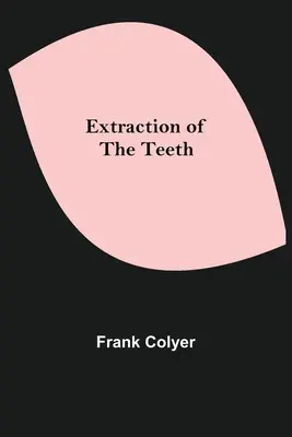 A fogak kihúzása - Extraction of the Teeth