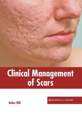 A hegek klinikai kezelése - Clinical Management of Scars