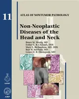 A fej és a nyak nem neoplasztikus betegségei - Non-Neoplastic Diseases of the Head and Neck