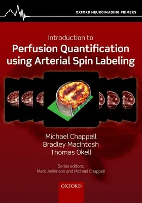 Bevezetés a perfúzió kvantitatív mérésébe az artériás spinjelölés alkalmazásával - Introduction to Perfusion Quantification Using Arterial Spin Labelling