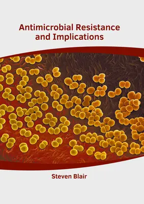 Antimikrobiális rezisztencia és következményei - Antimicrobial Resistance and Implications