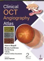 Klinikai OCT-angiográfia atlasz - Clinical OCT Angiography Atlas