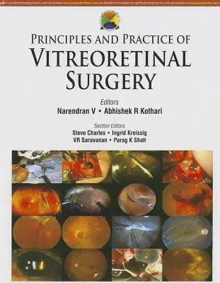 Az üveghártya-orvosi sebészet alapelvei és gyakorlata - Principles and Practice of Vitreoretinal Surgery