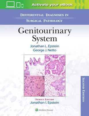 Differenciáldiagnózisok a sebészeti patológiában: Genitourinary System - Differential Diagnoses in Surgical Pathology: Genitourinary System