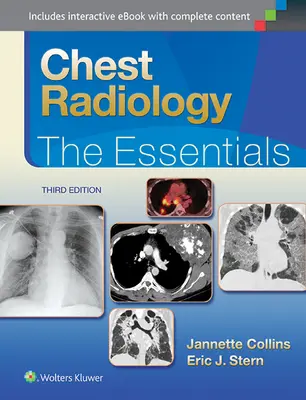 Mellkasi radiológia: A legfontosabb tudnivalók - Chest Radiology: The Essentials