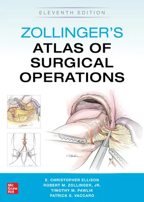 Zollinger's Atlas of Surgical Operations, tizenegyedik kiadás - Zollinger's Atlas of Surgical Operations, Eleventh Edition