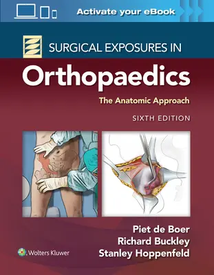 Sebészeti expozíciók az ortopédiában: Az anatómiai megközelítés - Surgical Exposures in Orthopaedics: The Anatomic Approach