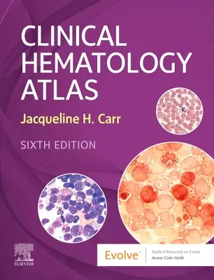 Klinikai hematológiai atlasz (Carr Jacqueline H. (Laboratóriumvezető Patológiai és Laboratóriumi Orvosi Osztály Clarian Health Indianapolis IN)) - Clinical Hematology Atlas (Carr Jacqueline H. (Laboratory Manager Department of Pathology and Laboratory Medicine Clarian Health Indianapolis IN))