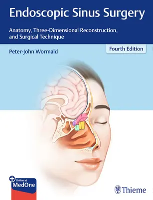 Endoszkópos arcüregsebészet: Anatómia, háromdimenziós rekonstrukció és műtéti technika - Endoscopic Sinus Surgery: Anatomy, Three-Dimensional Reconstruction, and Surgical Technique