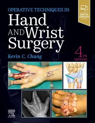 Operatív technikák: Kéz- és csuklósebészet - Operative Techniques: Hand and Wrist Surgery