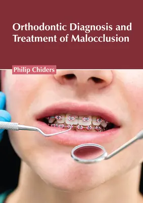 Fogszabályozás diagnózisa és kezelése a malokklúzióban - Orthodontic Diagnosis and Treatment of Malocclusion