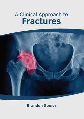 A törések klinikai megközelítése - A Clinical Approach to Fractures