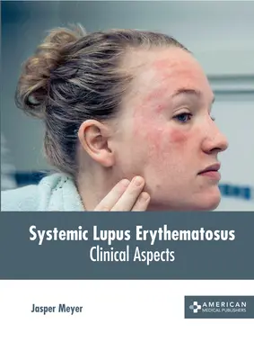 Szisztémás lupus erythematosus: Lupus heupusitis: Klinikai szempontok - Systemic Lupus Erythematosus: Clinical Aspects