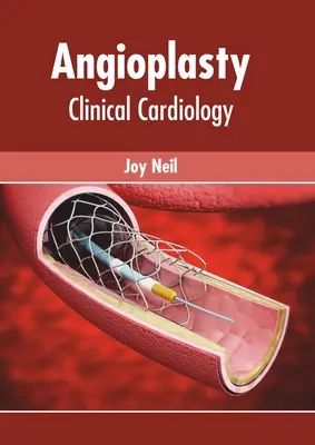 Angioplasztika: Kardiológia: Klinikai kardiológia - Angioplasty: Clinical Cardiology