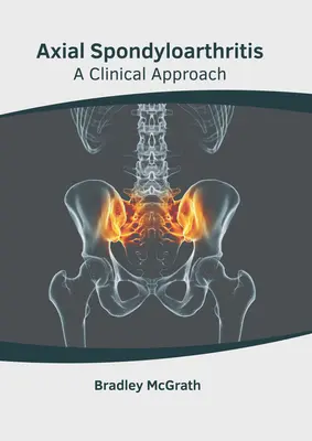 Axialis spondyloarthritis: A Clinical Approach - Axial Spondyloarthritis: A Clinical Approach