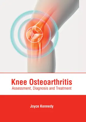 Knee Osteoarthritis: Felmérés, diagnózis és kezelés - Knee Osteoarthritis: Assessment, Diagnosis and Treatment