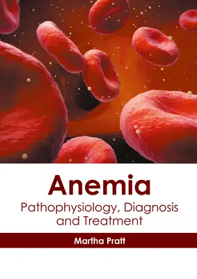 Vérszegénység: Pathophysiology, Diagnosis and Treatment - Anemia: Pathophysiology, Diagnosis and Treatment