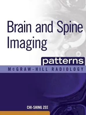 Agy- és gerincképalkotó minták: Agy és gerinc képalkotó eljárások - Brain and Spine Imaging Patterns: Brain & Spine Imaging