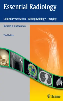 Alapvető radiológia: Klinikai bemutatás - patofiziológia - képalkotás - Essential Radiology: Clinical Presentation - Pathophysiology - Imaging