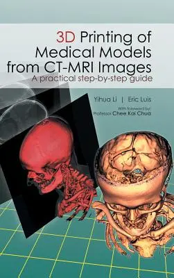 Orvosi modellek 3D nyomtatása CT-MRI-képekből: Gyakorlati útmutató lépésről lépésre - 3D Printing of Medical Models from CT-MRI Images: A Practical step-by-step guide