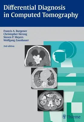 Differenciáldiagnózis a komputertomográfiában - Differential Diagnosis in Computed Tomography