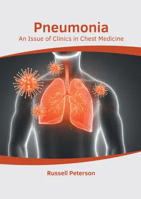 Tüdőgyulladás: A Clinics in Chest Medicine egyik száma - Pneumonia: An Issue of Clinics in Chest Medicine