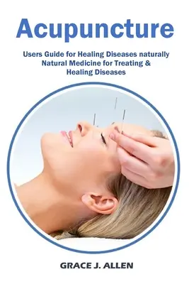 Akupunktúra: Természetes gyógymód a betegségek kezelésére és gyógyítására. - Acupuncture: Users Guide for Healing Diseases naturally Natural Medicine for Treating & Healing Diseases