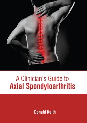 A klinikus útmutatója az axiális spondyloarthritishez - A Clinician's Guide to Axial Spondyloarthritis