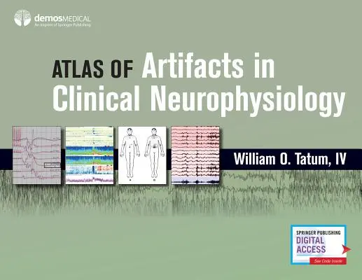 A klinikai neurofiziológia műtárgyatlasza - Atlas of Artifacts in Clinical Neurophysiology