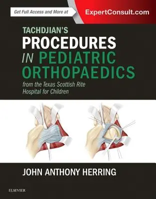 Tachdjian's Procedures in Pediatric Orthopaedics: A texasi skót rítusú gyermekkórházból - Tachdjian's Procedures in Pediatric Orthopaedics: From the Texas Scottish Rite Hospital for Children