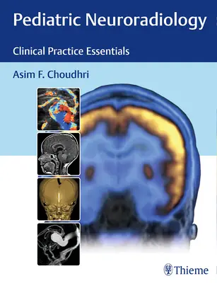 Gyermekneuroradiológia: Neuroradiológia: Klinikai gyakorlat alapjai - Pediatric Neuroradiology: Clinical Practice Essentials