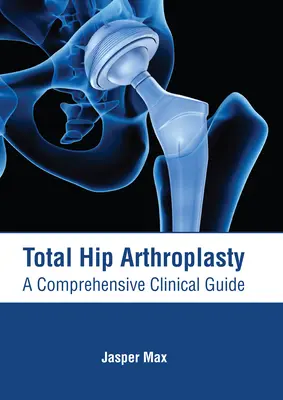 Teljes csípőízületi műtét: A Comprehensive Clinical Guide (Átfogó klinikai útmutató) - Total Hip Arthroplasty: A Comprehensive Clinical Guide