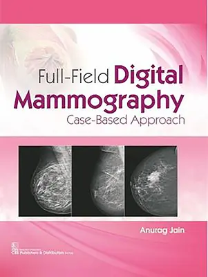 Teljes mezős digitális mammográfia: Esetalapú megközelítés - Full-Field Digital Mammography: Case-Based Approach