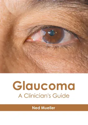 Glaukóma: A Clinician's Guide - Glaucoma: A Clinician's Guide