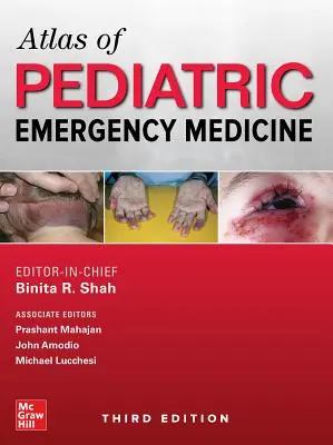 A sürgősségi gyermekgyógyászat atlasza, harmadik kiadás - Atlas of Pediatric Emergency Medicine, Third Edition