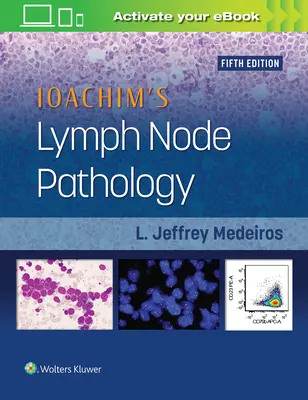 Ioachim nyirokcsomó patológiája - Ioachim's Lymph Node Pathology